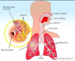 Understanding bronchitis		